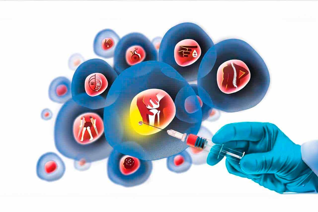 terapia-regenerativa-factores-crecimiento-celulas-madre-sabadell-002