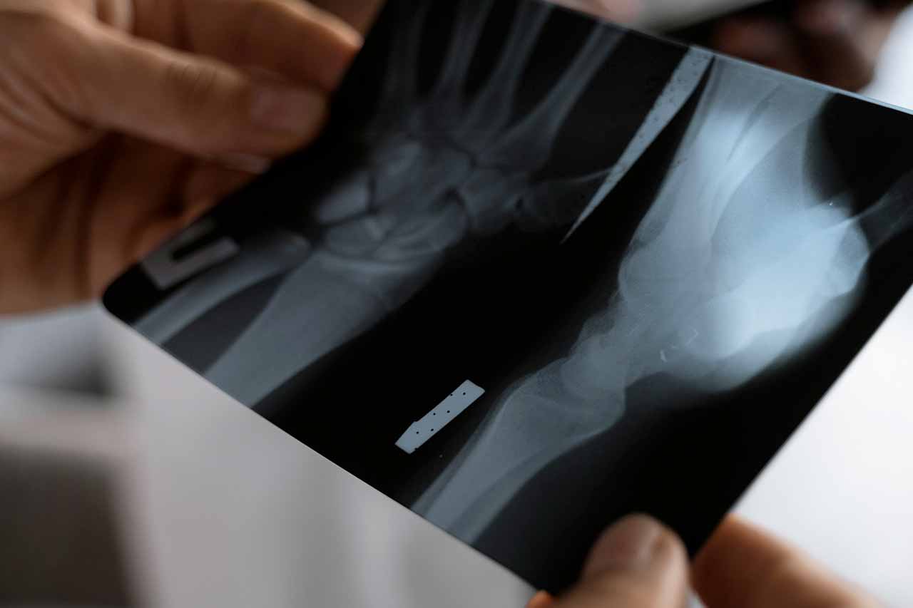 trauamtologia-trauamtologo-en-sabadell-novamedicum-rx